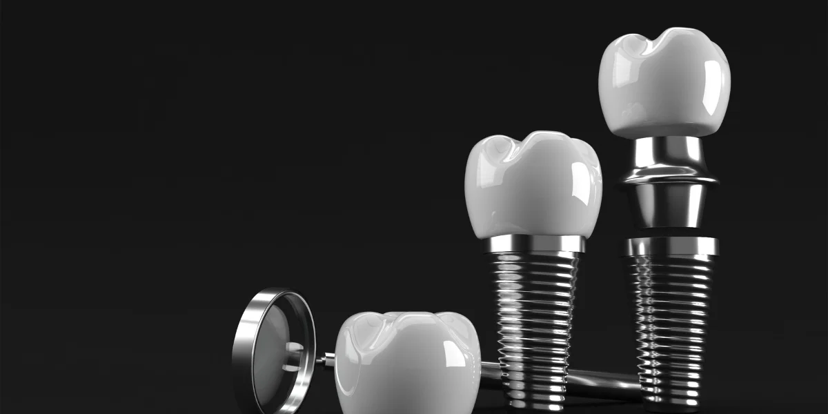 Maintaining Dental Implants