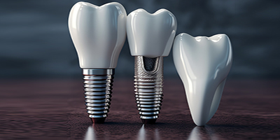 Maintaining Dental Implants