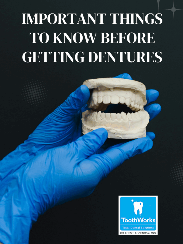Important Things to Know Before Getting Dentures