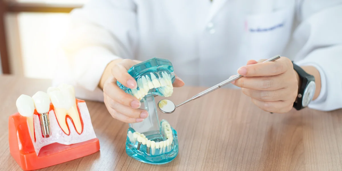 Dental Implants Hygiene