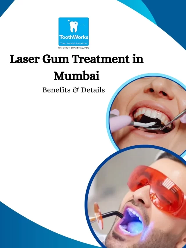 Laser Gum Treatment in Mumbai