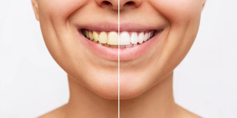 Mouth Rehabilitation Clinic in Mumbai