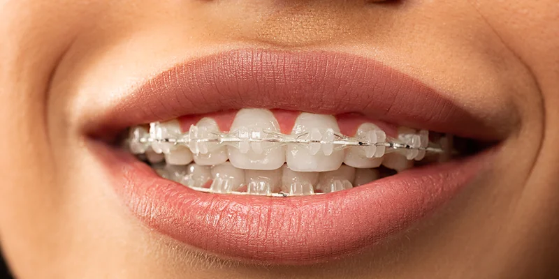 Orthodontics Dental Clinic