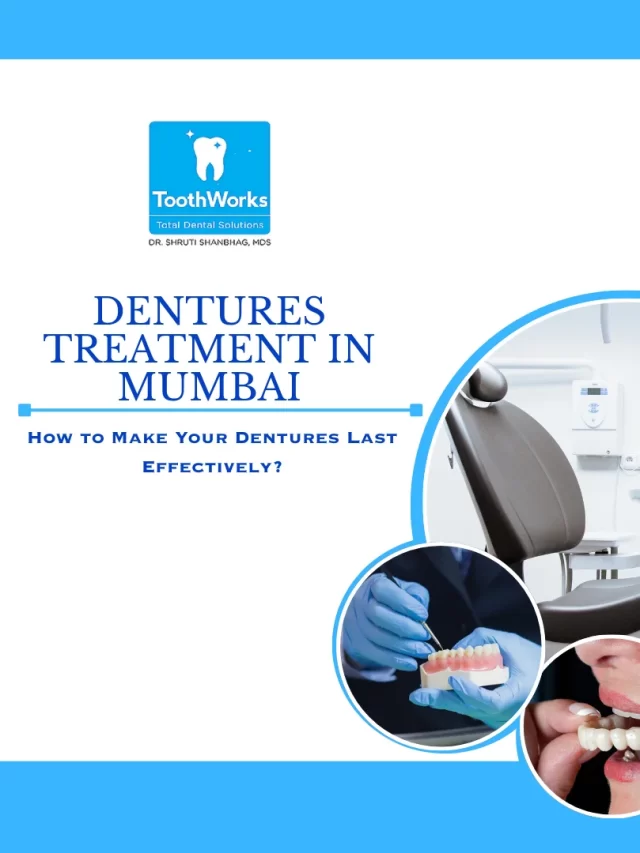 Dentures Treatment in Mumbai