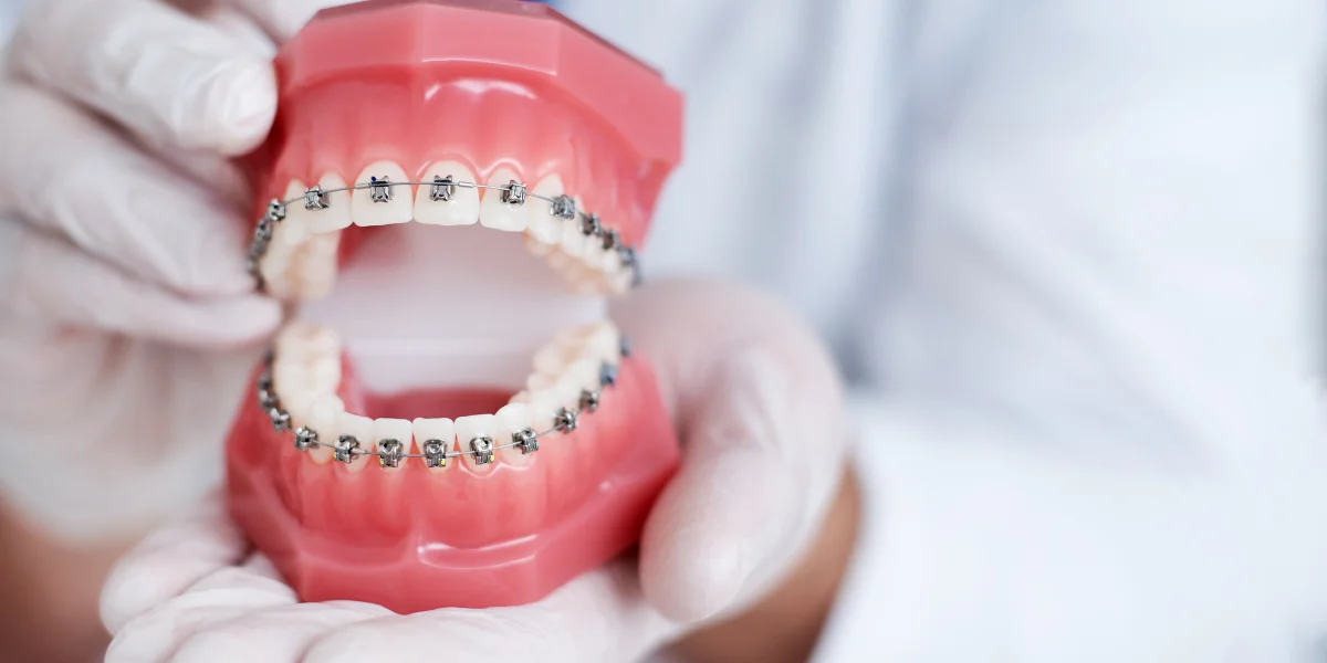 Orthodontics Dental Treatment
