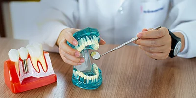 Dental Implants Hygiene