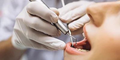 Painless Dental Implants