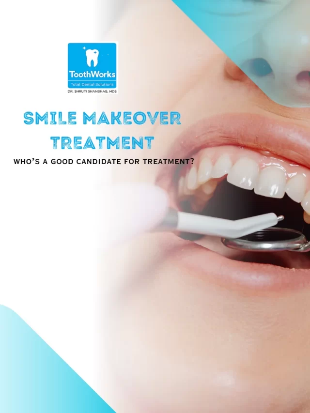 Smile Makeover Treatment