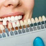 Smile Makeover in Mumbai