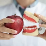 Diet After Dental Implant