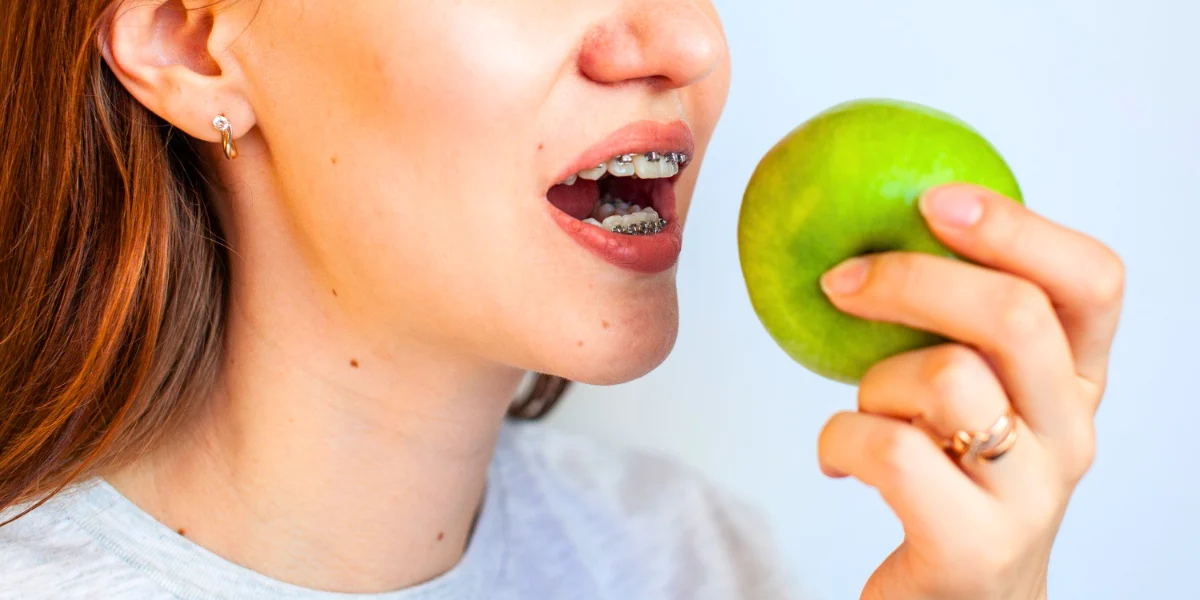 Orthodontic Treatment