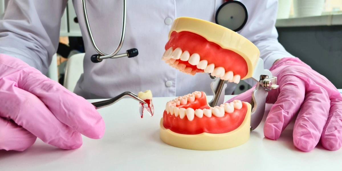Full Mouth Reconstruction Treatment