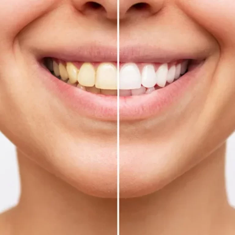 Mouth Rehabilitation Clinic in Mumbai