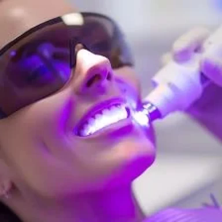 Laser Gum Therapy
