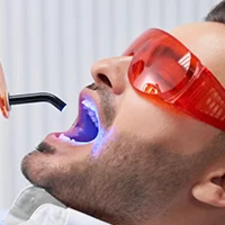 Laser Treatment