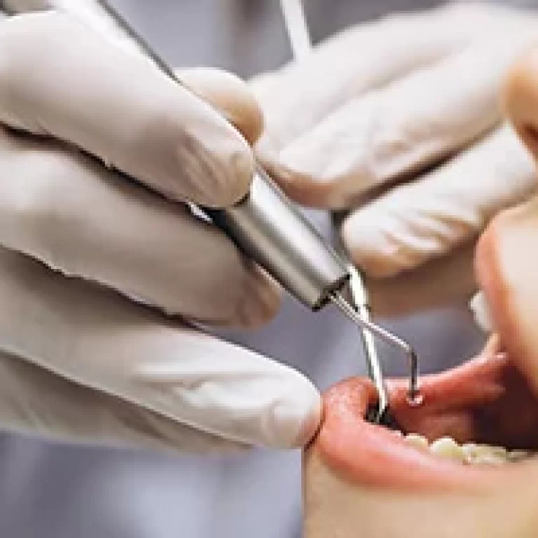 Painless Dental Implants