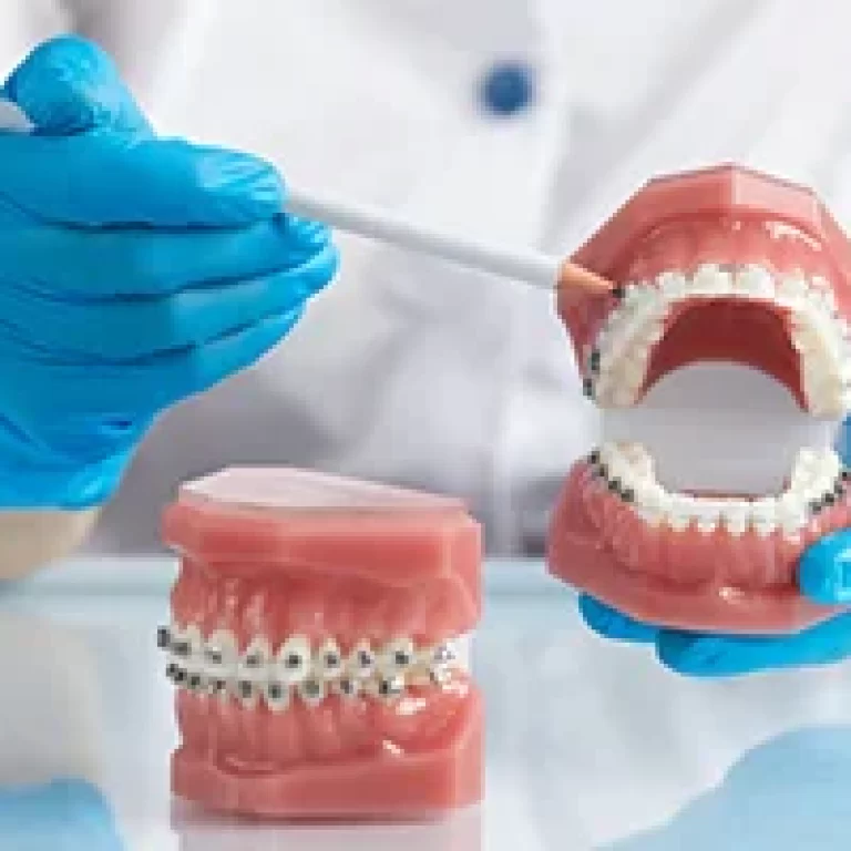 Orthodontist vs. Periodontist