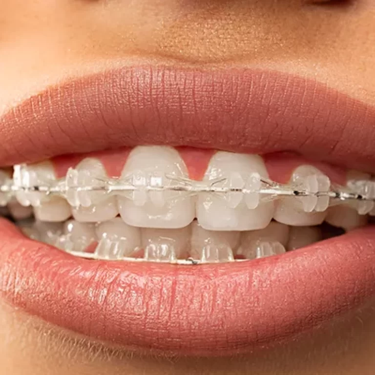 Orthodontics Dental Clinic