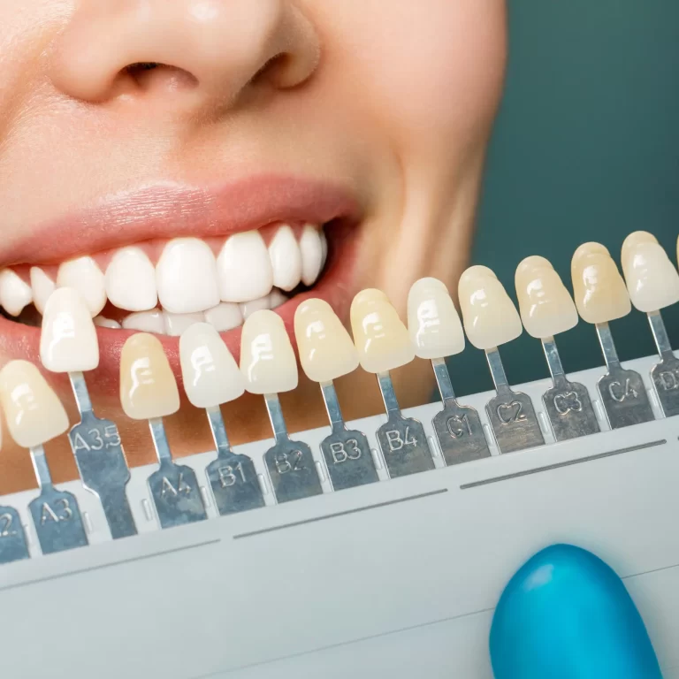 Smile Makeover in Mumbai